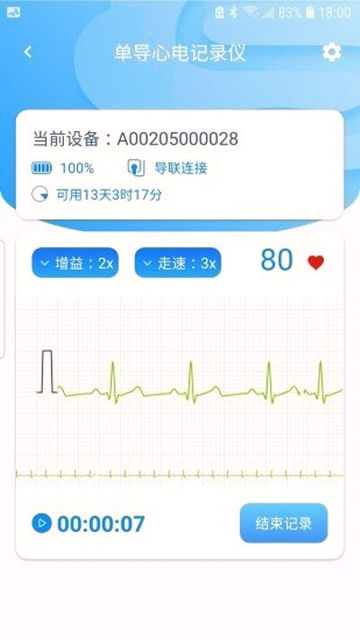 星康心电截图2