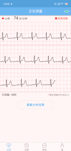 数维康心电截图2